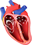 Atrial Fibrillation