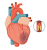 Best Heart Failure Treatment in Raipur