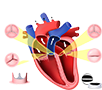 Interventional Cardiology